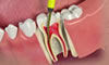 FOTO ENDODONTIA